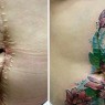 tatuajes-de-cicatrices